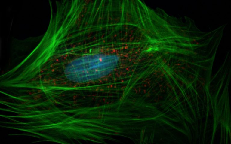 Fibroblast confocal microscopy image